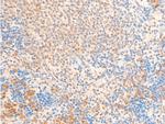 Phospho-FOXO3A (Ser253) Antibody in Immunohistochemistry (Paraffin) (IHC (P))