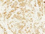 Phospho-FOXO3A (Ser253) Antibody in Immunohistochemistry (Paraffin) (IHC (P))