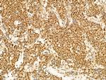 Phospho-FOXO3A (Ser253) Antibody in Immunohistochemistry (Paraffin) (IHC (P))