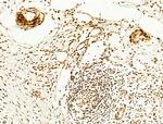 Phospho-FOXO3A (Ser253) Antibody in Immunohistochemistry (Paraffin) (IHC (P))