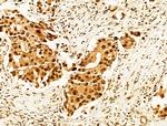 Phospho-FOXO3A (Ser253) Antibody in Immunohistochemistry (Paraffin) (IHC (P))