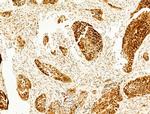 Phospho-FOXO3A (Ser253) Antibody in Immunohistochemistry (Paraffin) (IHC (P))