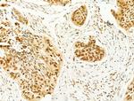 Phospho-FOXO3A (Ser253) Antibody in Immunohistochemistry (Paraffin) (IHC (P))