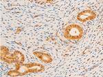 Phospho-FOXO3A (Ser253) Antibody in Immunohistochemistry (Paraffin) (IHC (P))