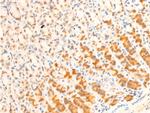 Phospho-FOXO3A (Ser253) Antibody in Immunohistochemistry (Paraffin) (IHC (P))