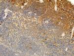 Phospho-ROCK2 (Tyr722) Antibody in Immunohistochemistry (Paraffin) (IHC (P))