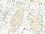 Phospho-ROCK2 (Tyr722) Antibody in Immunohistochemistry (Paraffin) (IHC (P))