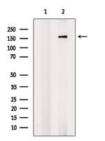 Phospho-ROCK2 (Tyr722) Antibody in Western Blot (WB)