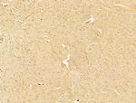 Phospho-PI3K p85/p55 (Tyr467, Tyr199) Antibody in Immunohistochemistry (Paraffin) (IHC (P))