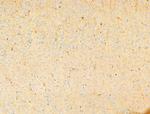 Phospho-PI3K p85/p55 (Tyr467, Tyr199) Antibody in Immunohistochemistry (Paraffin) (IHC (P))