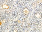 Phospho-PI3K p85/p55 (Tyr467, Tyr199) Antibody in Immunohistochemistry (Paraffin) (IHC (P))