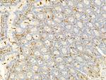 Phospho-PI3K p85/p55 (Tyr467, Tyr199) Antibody in Immunohistochemistry (Paraffin) (IHC (P))