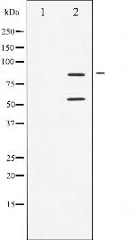 Phospho-PI3K p85/p55 (Tyr467, Tyr199) Antibody in Western Blot (WB)