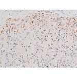 Phospho-JNK1/JNK2/JNK3 (Thr183, Tyr185) Antibody in Immunohistochemistry (Paraffin) (IHC (P))