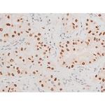 Phospho-JNK1/JNK2/JNK3 (Thr183, Tyr185) Antibody in Immunohistochemistry (Paraffin) (IHC (P))