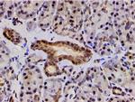 Phospho-LIMK1 (Thr508) Antibody in Immunohistochemistry (Paraffin) (IHC (P))