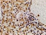 Phospho-LIMK1 (Thr508) Antibody in Immunohistochemistry (Paraffin) (IHC (P))