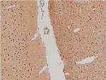 Phospho-LIMK1 (Thr508) Antibody in Immunohistochemistry (Paraffin) (IHC (P))