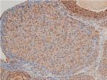 Phospho-LIMK1 (Thr508) Antibody in Immunohistochemistry (Paraffin) (IHC (P))