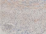 Phospho-LIMK1 (Thr508) Antibody in Immunohistochemistry (Paraffin) (IHC (P))