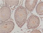 Phospho-LIMK1 (Thr508) Antibody in Immunohistochemistry (Paraffin) (IHC (P))