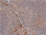 Phospho-LIMK1 (Thr508) Antibody in Immunohistochemistry (Paraffin) (IHC (P))