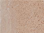 Phospho-LIMK1 (Thr508) Antibody in Immunohistochemistry (Paraffin) (IHC (P))