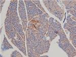 Phospho-LIMK1 (Thr508) Antibody in Immunohistochemistry (Paraffin) (IHC (P))