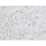 Phospho-LIMK1 (Thr508) Antibody in Immunohistochemistry (Paraffin) (IHC (P))