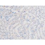 Phospho-LIMK1 (Thr508) Antibody in Immunohistochemistry (Paraffin) (IHC (P))