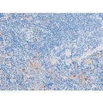 Phospho-LIMK1 (Thr508) Antibody in Immunohistochemistry (Paraffin) (IHC (P))