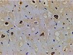 Phospho-LIMK1 (Thr508) Antibody in Immunohistochemistry (Paraffin) (IHC (P))