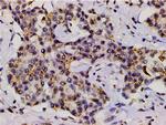 Phospho-LIMK1 (Thr508) Antibody in Immunohistochemistry (Paraffin) (IHC (P))