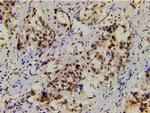 Phospho-LIMK1 (Thr508) Antibody in Immunohistochemistry (Paraffin) (IHC (P))