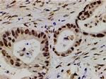 Phospho-LIMK1 (Thr508) Antibody in Immunohistochemistry (Paraffin) (IHC (P))