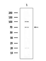 FOXP1 Antibody in Western Blot (WB)