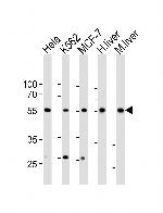 BMPR1A Antibody in Western Blot (WB)