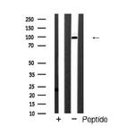 mGluR4 Antibody in Western Blot (WB)