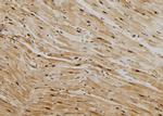 HSP70 Antibody in Immunohistochemistry (Paraffin) (IHC (P))