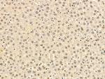 HSP70 Antibody in Immunohistochemistry (Paraffin) (IHC (P))