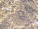 HSP70 Antibody in Immunohistochemistry (Paraffin) (IHC (P))