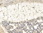 HSP70 Antibody in Immunohistochemistry (Paraffin) (IHC (P))