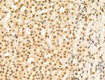 HSP70 Antibody in Immunohistochemistry (Paraffin) (IHC (P))