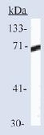 HSP70 Antibody in Western Blot (WB)