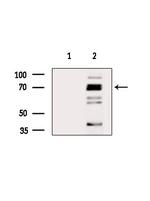 HSP70 Antibody in Western Blot (WB)