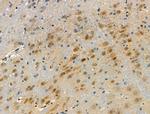 Phospho-LIMK1 (Ser323) Antibody in Immunohistochemistry (Paraffin) (IHC (P))