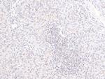 Phospho-PDGFRB (Tyr579, Tyr581) Antibody in Immunohistochemistry (Paraffin) (IHC (P))