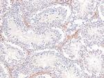 Phospho-PDGFRB (Tyr579, Tyr581) Antibody in Immunohistochemistry (Paraffin) (IHC (P))