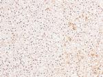 Phospho-PDGFRB (Tyr579, Tyr581) Antibody in Immunohistochemistry (Paraffin) (IHC (P))