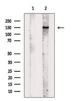 Phospho-PDGFRB (Tyr579, Tyr581) Antibody in Western Blot (WB)